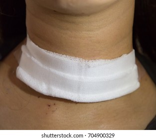 Zooming close-up anterior or frontal view of gauze packing on neck in order to prevent post-surgical wound from any dirty environments in a young Asian female underwent thyroid surgery in a hospital