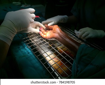 Zooming closeup view of irrigation cut wound two fingers at right hand on medical metallic tray of a young male patient with history of accidental knife cutting on his agricultural work