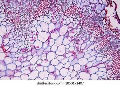 Zygomycota, Or Zygote Fungi Or Downy Mildew Living In Decaying Plant On Slide Under The Microscope For Education.
