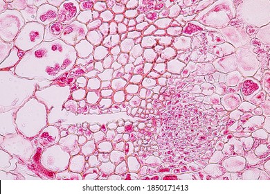 Zygomycota, Or Zygote Fungi Or Downy Mildew Living In Decaying Plant On Slide Under The Microscope For Education.
