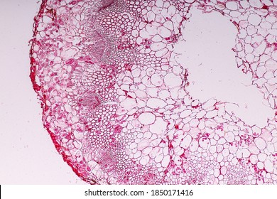 Zygomycota, Or Zygote Fungi Or Downy Mildew Living In Decaying Plant On Slide Under The Microscope For Education.
