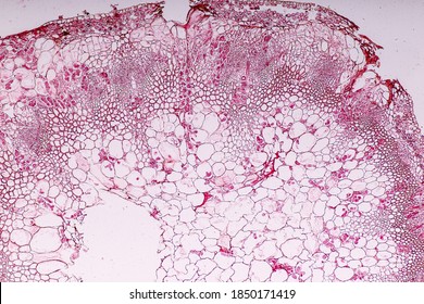 Zygomycota, Or Zygote Fungi Or Downy Mildew Living In Decaying Plant On Slide Under The Microscope For Education.
