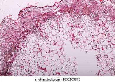 Zygomycota, Or Zygote Fungi Or Downy Mildew Living In Decaying Plant On Slide Under The Microscope For Education.
