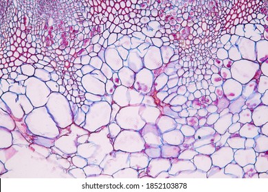 Zygomycota, Or Zygote Fungi Or Downy Mildew Living In Decaying Plant On Slide Under The Microscope For Education.
