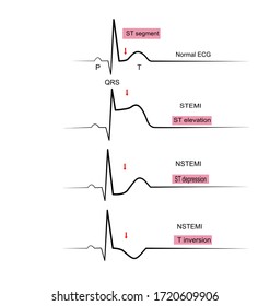 Stemi Hd Stock Images Shutterstock