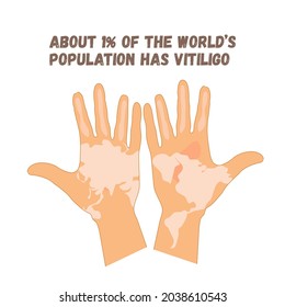 2 hands with light world map on palm, world vitiligo symbols concept with quote world population