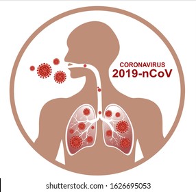 2019-nCoV. illness respiratory coronavirus 2019-nCoV. Flu spreading of world, Middle East respiratory syndrome coronavirus concept with human  virus enters the lungs, vector illustration