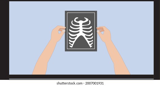 2d illustration x ray for human rib checking doctor
