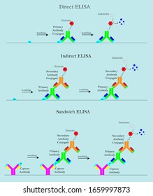 3-Typ-ELISA im Labor Direct ELISA, Indirect ELISA, Sandwich ELISA, Biotechnologie-Immunoassay