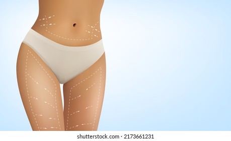 3D Cosmetic Surgery Or Skin Liposuction Banner Template. EPS10 Vector