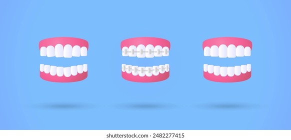 Ilustración editable 3d dientes blancos tratamiento de ortodoncia Vector púrpura, rosa y azul, 3d, Vector, adecuado para ilustraciones de Web, páginas de aterrizaje. alineación de dientes, antes después del concepto.