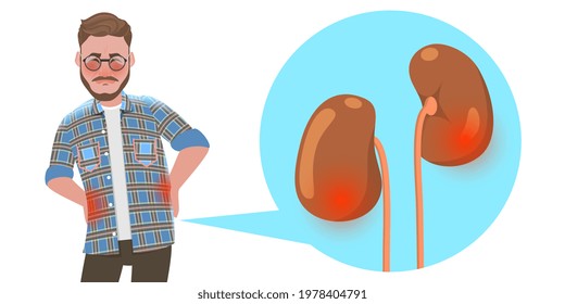 3D Flat Vector Conceptual Illustration of Kidney Stones Disease, Urinary System Disorders