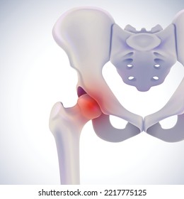 3D illustration of anterior view of hip bone showing painful position on white. medical use Education and Commerce.