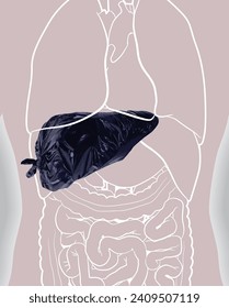 3D illustration of a garbage bag in the shape of a human liver, comparable to a human liver that accumulates waste and causes serious illness. Used in medicine, in advertising and commerce.