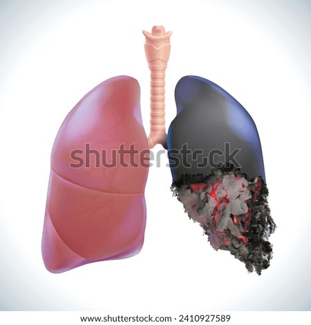 3D illustration of one human lung being a healthy lung, the other being an unhealthy lung, burned like the end of a lit cigarette. Used in medicine, advertising, commerce and industry.
