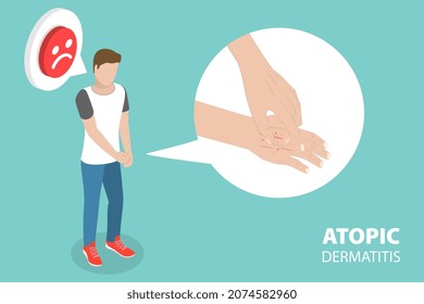 3D Isometric Flat Vector Conceptual Illustration of Atopic Dermatitis, Unhappy Sick Man Scratch its Hand Suffering From Itch