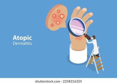3D Isometric Flat Vector Conceptual Illustration of Atopic Dermatitis, Patient Skin Allergic Reaction