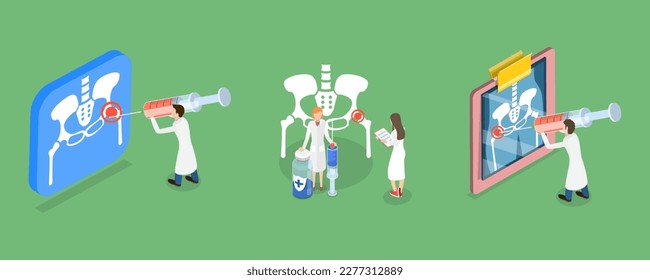 3D Isometrisches Flachbild-Vektorgrafik Konzeptuelle Illustration der Hip-Joint-Cortison-Injektion, Knochen des Pelvis und der Hüfte, Anatomie des Menschen