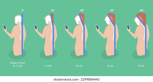 3D Isometric Flat Vector Conceptual Illustration of Phone Posture, Stage Text Neck Syndrome