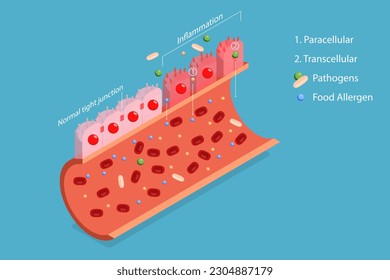 3D Isometric Flat Vector Conceptual Illustration of Leaky Gut Syndrome, Autoimmune Disorder