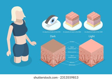 Ilustración conceptual del albinismo en el vector plano isométrico 3D, comparación de la sección transversal de la piel normal con la falta de melanocitos