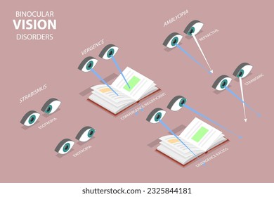 3D Isometric Flat Vector Conceptual Illustration of Binocular Vision Disorders, Medical Sight Health Problems