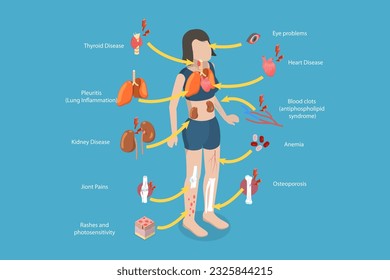 3D Isometric Flat Vector Conceptual Illustration of Lupus Erythematosus, SLE Symptoms and Signs