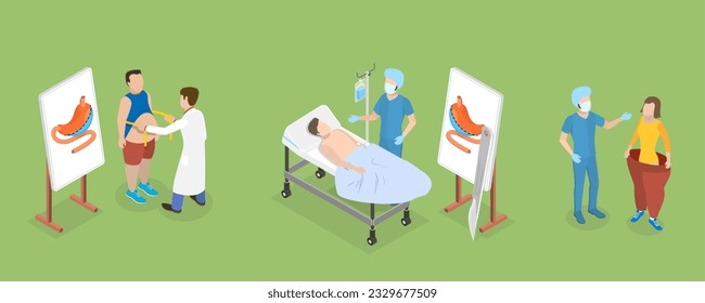 3D Isometrisches flaches Vektorgrafik Konzeptgrafik Bariatchirurgie, Vertikales Schlupfgastrektomie