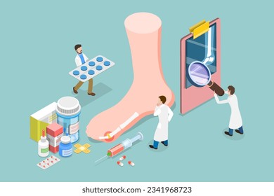 3D Isometric Flat Vector Conceptual Illustration of Gout Treatment, Medical Appointment and Exam