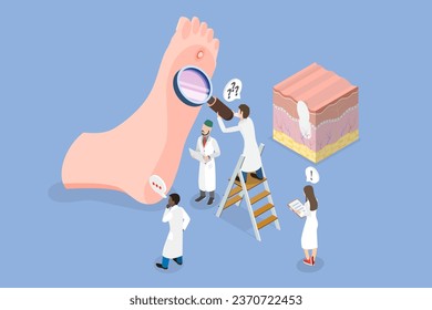 3D-Isometrisches Flachbild-Vektorgrafik - Conceptual Illustration of Foot Wart