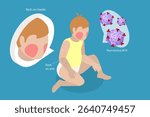 3D Isometric Flat Vector Illustration of Sick Crying Baby, Facial Reaction In Child With Fifth Disease