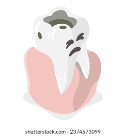 3D Isometric Flat Vector Illustration of Tooth Decay. Item 2