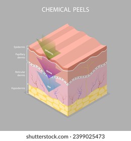 3D Isometric Flat Vector Illustration of Skin Chemical Peel