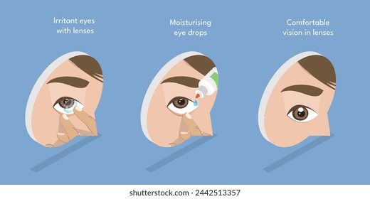 3D Isometric Flat Vector Illustration of Moisturizing Eye Drops, Using of Artificial Tears