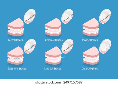 3D Isometric Flat Vector Illustration of Dental Teeth Braces Types, Orthodontic Options for Teeth Straightening