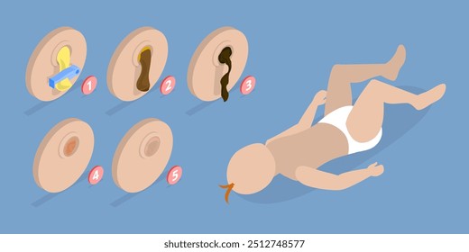 3D Isometrische flache Vektorgrafik der Nabelschnur, nach der Geburt Phasen. Geschwollen, trockener Eiter, Narbengewebe, Abfall