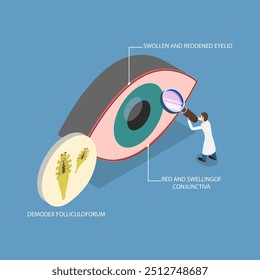 3D Isometric Flat Vector Illustration of Demodex Folliculorum, Demodicosis Affecting the Eyelid and Causing Red Eyes