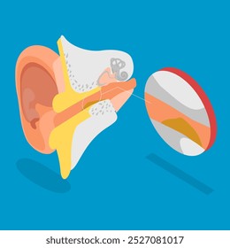 3D Isometric Flat Vector Illustration of Earwax Blockage, Blocked Ear Canal Due To Excess Ear Wax Buildup