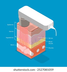 Ilustração de vetor plano isométrica 3D da terapia a laser, aliviando a dor do paciente e estimulando a cura