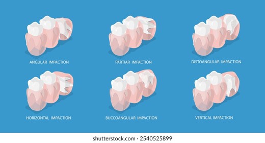 3D Isometric Flat Vector Illustration of Wisdoms Teeth Dental Problem, Orthodontic and Dentistry