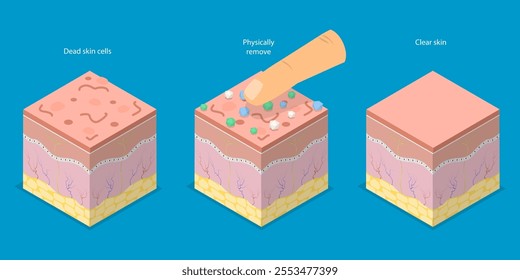 3D Isometric Flat Vector Illustration of Skin Peeling, Mechanical Exfoliation For Skin Renewal