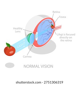 3D Isometric Flat Vector Illustration of Vision Disorder, Far-Sightedness And Near-Sightedness Anatomical Diagram. Item 3