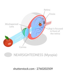 3D Isometric Flat Vector Illustration of Vision Disorder, Far-Sightedness And Near-Sightedness Anatomical Diagram. Item 1