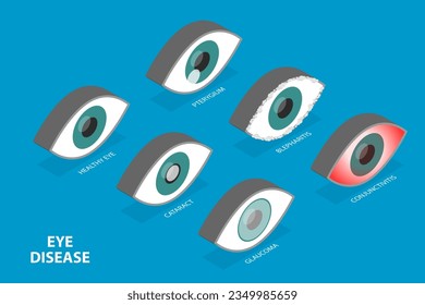 Grupo de vectores planos isométricos 3D de ojos con diferentes problemas, ojos humanos y salud de la visión