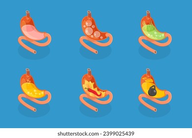3D Isometric Flat Vector Set of Stomach Problems