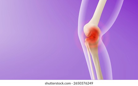 Visualização da dor no joelho 3d - ossos da perna com inflamação vermelha brilham na área da articulação em fundo gradiente roxo. Conceito médico mostrando artrite, local da lesão para diagnóstico e tratamento ortopédicos
