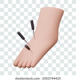 3D leg with special long needles. Vector mockup for advertisement of acupuncture