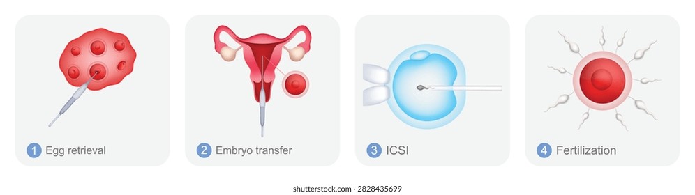 3d medical vector set illustrating key procedures and stages related to in vitro fertilization (IVF), including egg retrieval, embryo transfer, intracytoplasmic sperm injection (ICSI), and fertilization. Suitable for fertility clinics, assisted reproduction, reproductive medicine, gynecology, embryology, infertility treatment, IVF education, healthcare websites, and patient information materials.