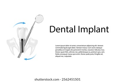 3D realistic composition of dental implantation. Illustration of dental activity.