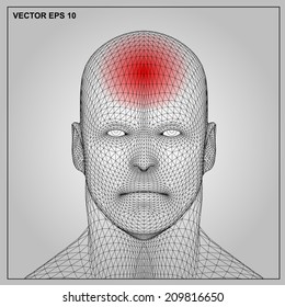 3d render Medical illustration showing inflamed, painful.